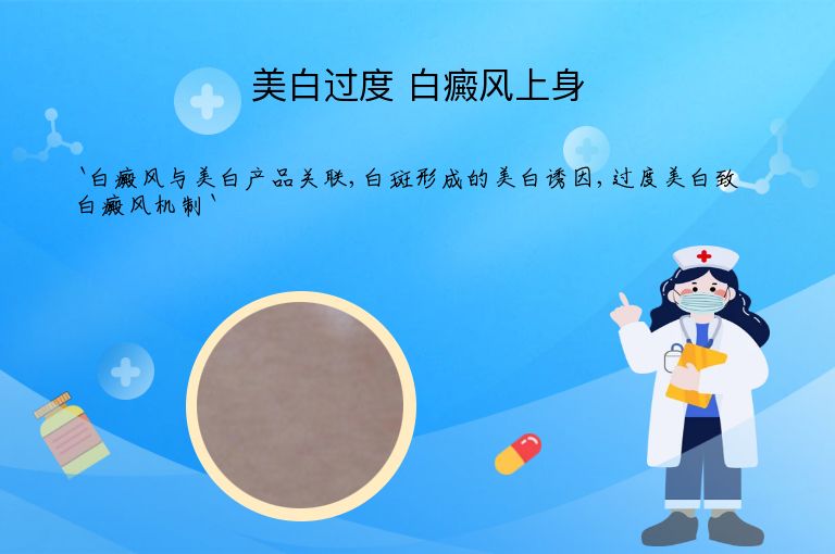 美白过度 白癜风上身”