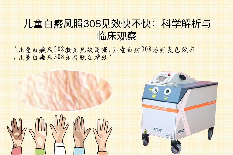 儿童白癜风照308见效快不快：科学解析与临床观察