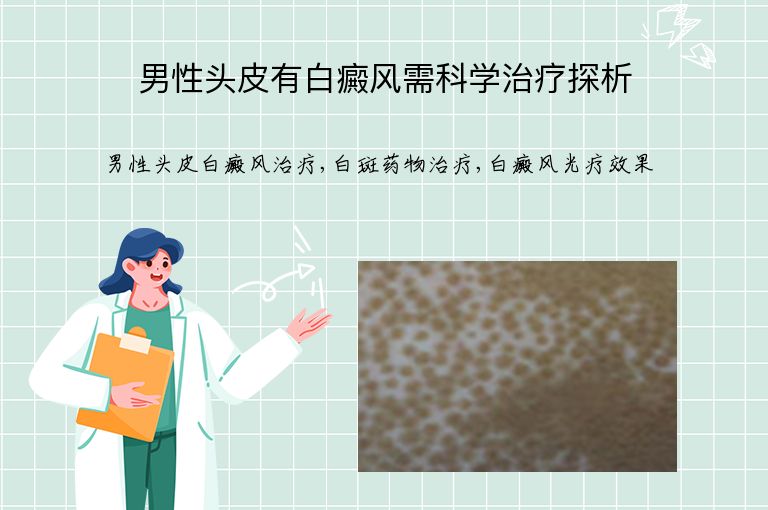 男性头皮有白癜风需科学治疗探析”