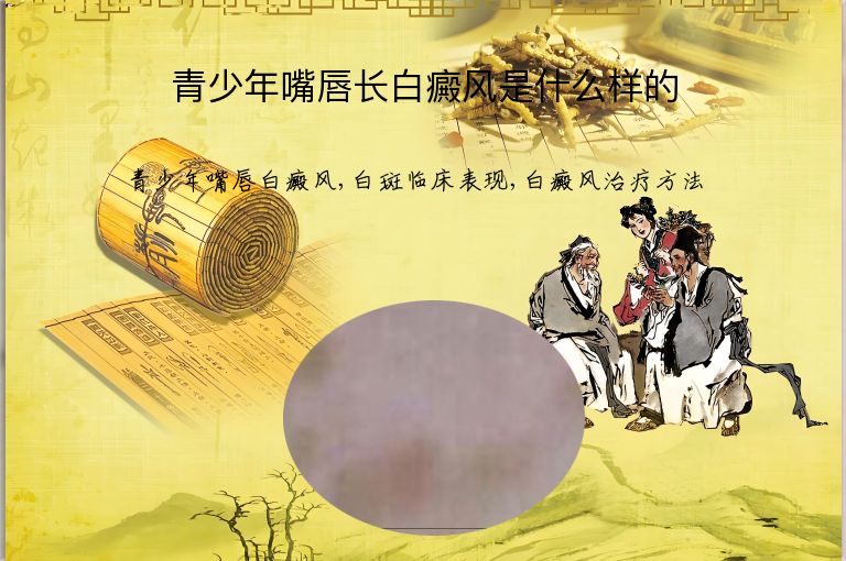 青少年嘴唇长白癜风是什么样的”