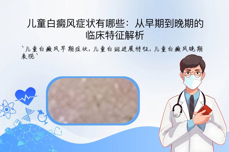 儿童白癜风症状有哪些:从早期到晚期的临床特征解析