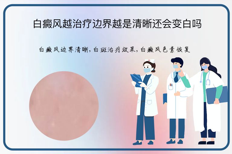 白癜风越治疗边界越是清晰还会变白吗”