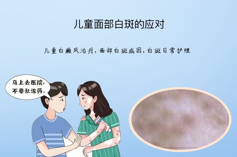 儿童面部白斑的应对”