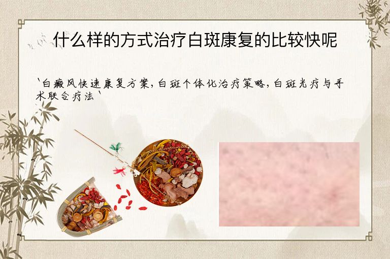 什么样的方式治疗白斑康复的比较快呢
