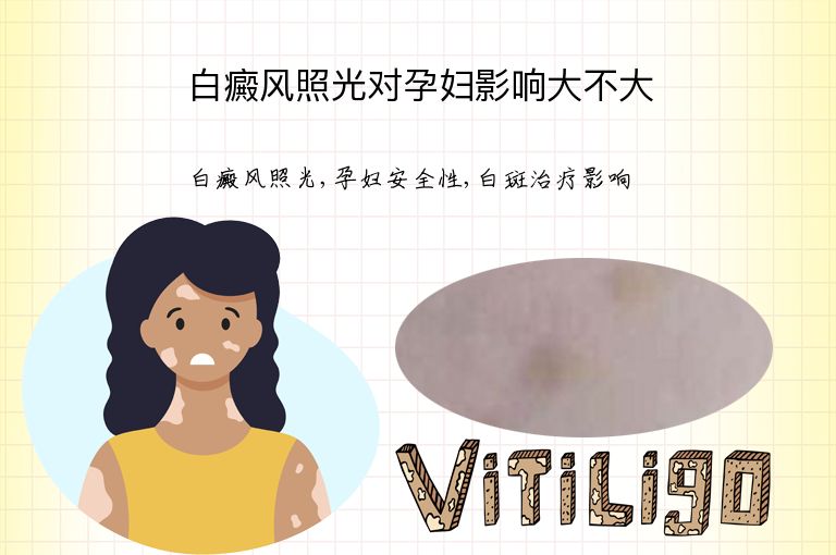https://www.bdfsjzyy.com/d/file/p/98f48b5942ae8d667b3318de39273c64.jpeg
