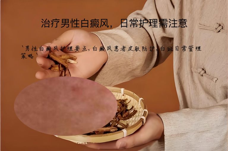 治疗男性白癜风，日常护理需注意