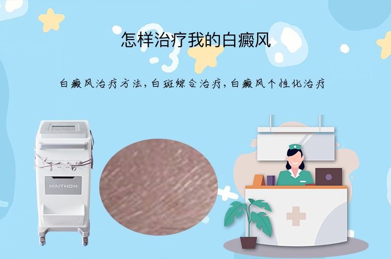 怎样治疗我的白癜风”
