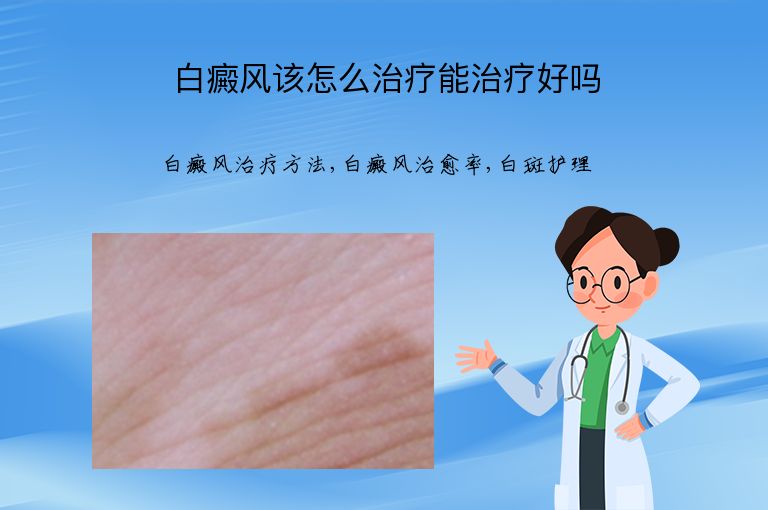 白癜风该怎么治疗能治疗好吗”
