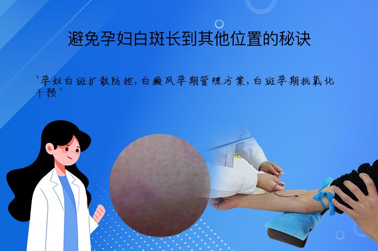 避免孕妇白斑长到其他位置的秘诀