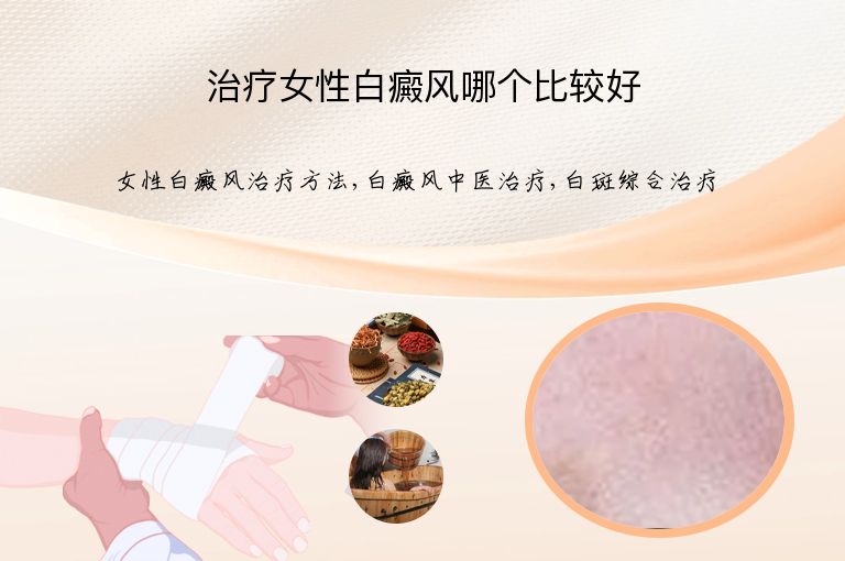 https://www.bdfsjzyy.com/d/file/p/274ef15c30a4e6efd65c426496e6187c.jpeg