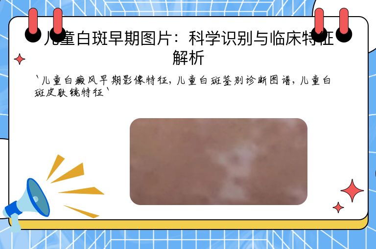 儿童白斑早期图片：科学识别与临床特征解析