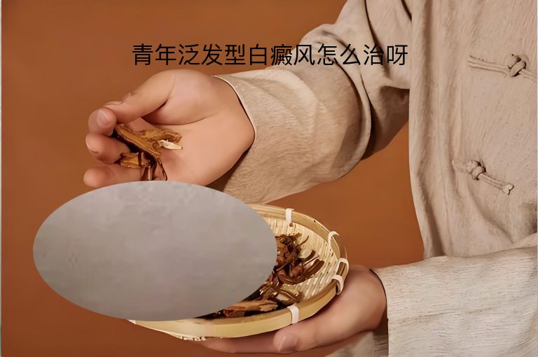 青年泛发型白癜风怎么治呀”
