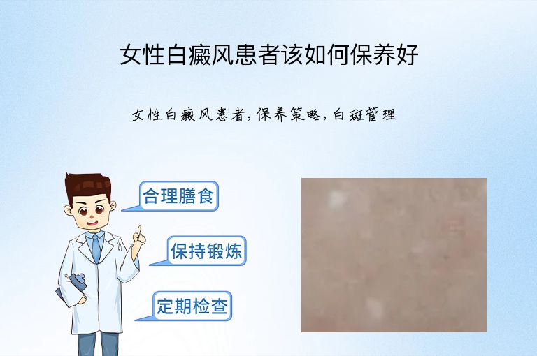 女性白癜风患者该如何保养好”