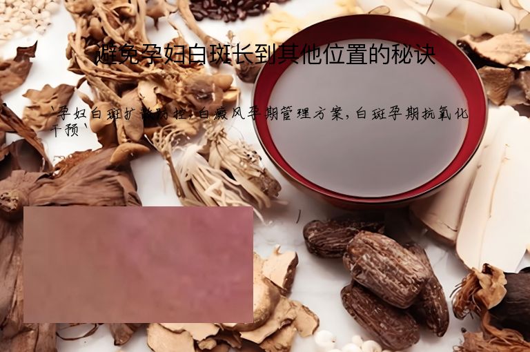 避免孕妇白斑长到其他位置的秘诀