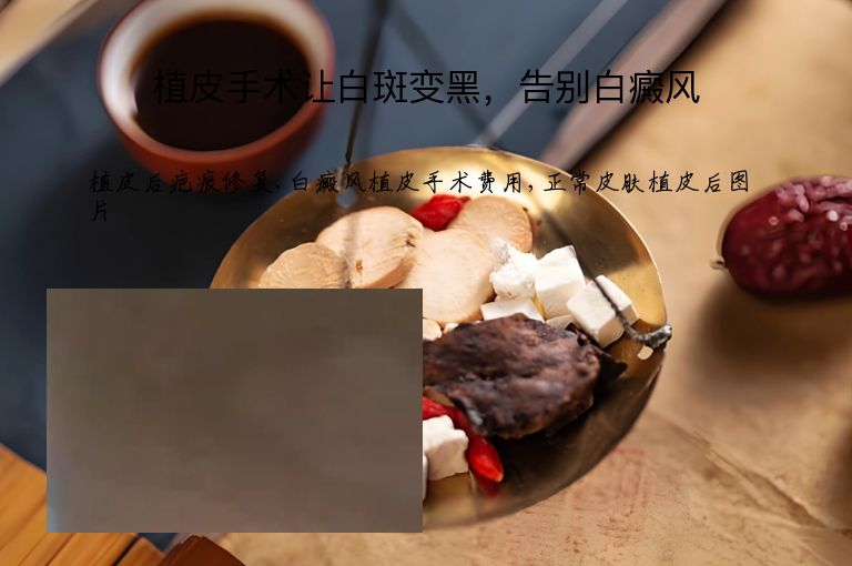 植皮手术让白斑变黑，告别白癜风”