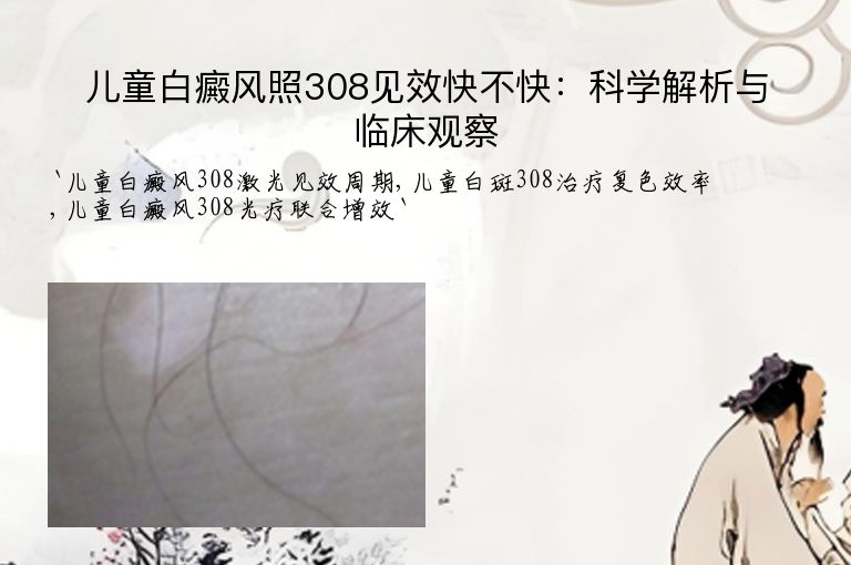 儿童白癜风照308见效快不快:科学解析与临床观察
