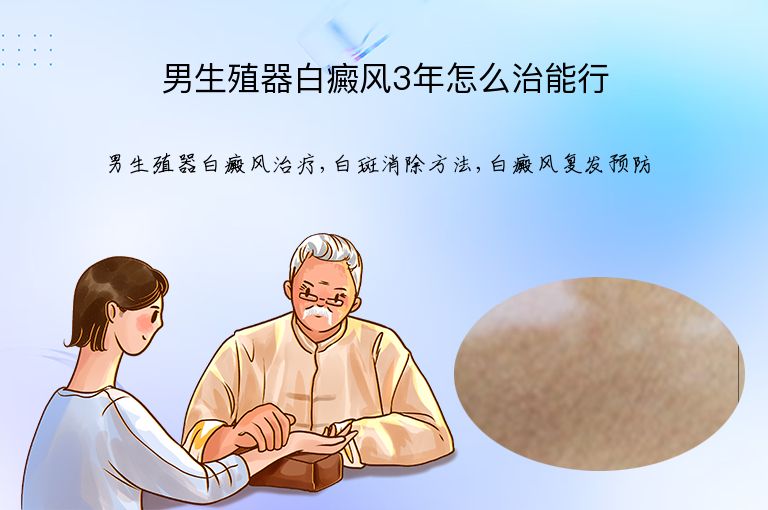 https://www.bdfsjzyy.com/d/file/p/8b3486e2d9510e075b9a805ff40a8080.jpeg