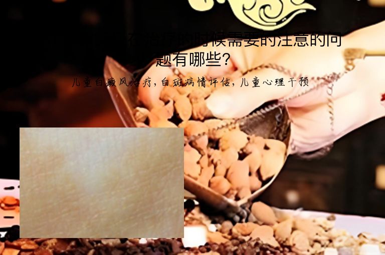 儿童白癜风在治疗的时候需要的注意的问题有哪些?”