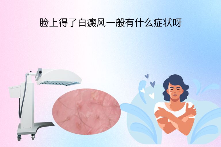 脸上得了白癜风一般有什么症状呀