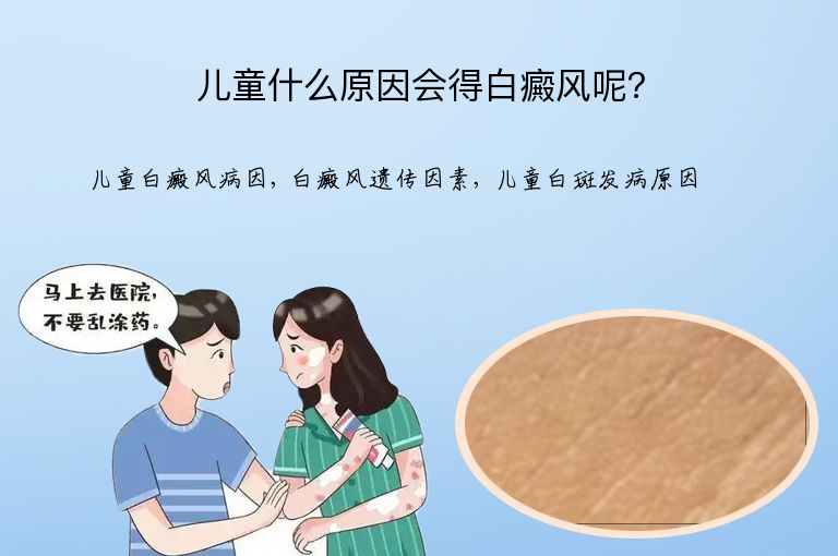儿童什么原因会得白癜风呢？”