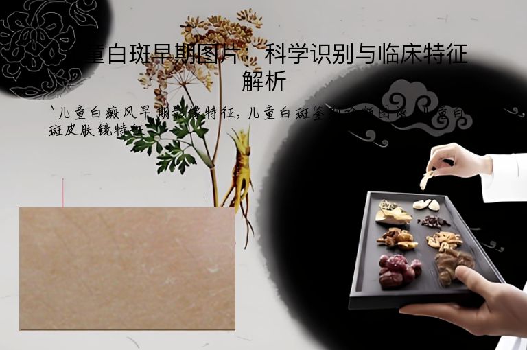 儿童白斑早期图片：科学识别与临床特征解析