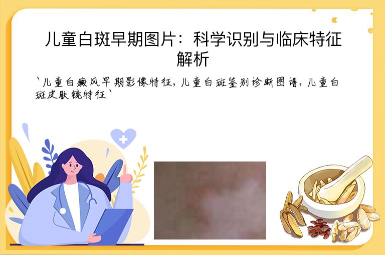 儿童白斑早期图片:科学识别与临床特征解析