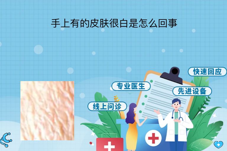 手上有的皮肤很白是怎么回事