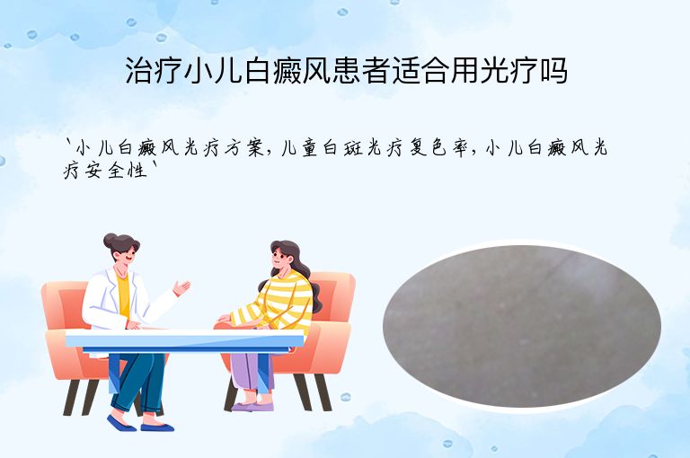 治疗小儿白癜风患者适合用光疗吗