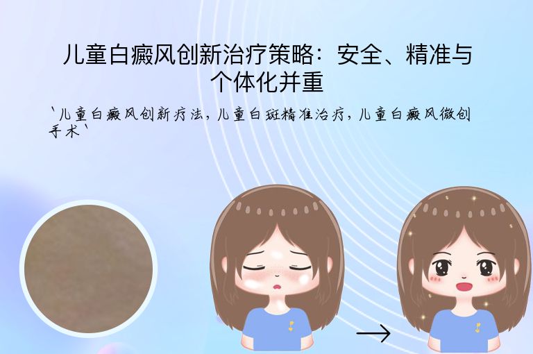 儿童白癜风创新治疗策略：安全、精准与个体化并重