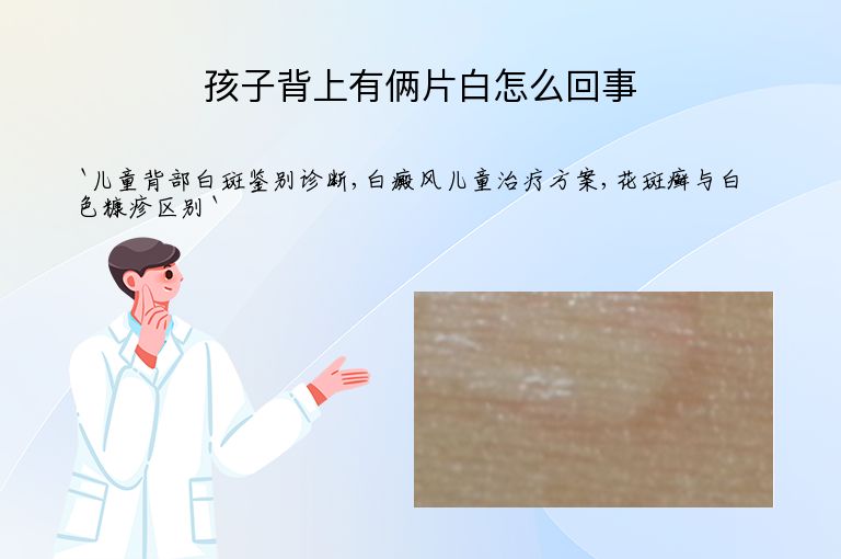 孩子背上有俩片白怎么回事