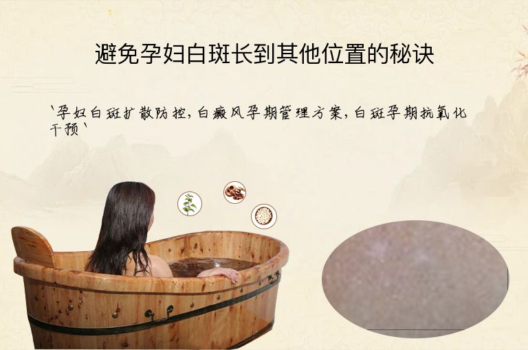避免孕妇白斑长到其他位置的秘诀