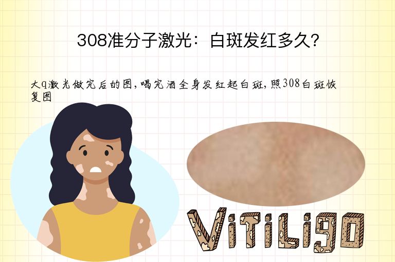 308准分子激光：白斑发红多久？”