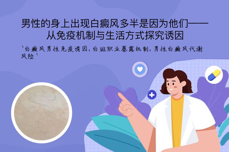 男性的身上出现白癜风多半是因为他们——从免疫机制与生活方式探究诱因