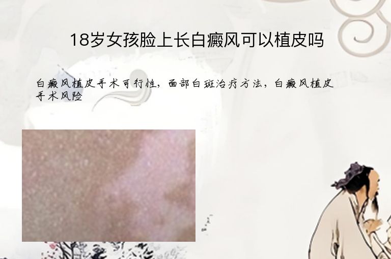 18岁女孩脸上长白癜风可以植皮吗”