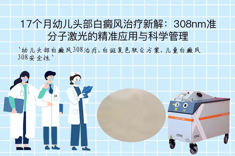 17个月幼儿头部白癜风治疗新解：308nm准分子激光的精准应用与科学管理”