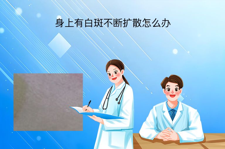身上有白斑不断扩散怎么办”