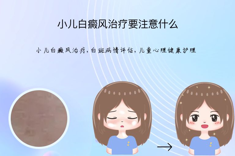 小儿白癜风治疗要注意什么”
