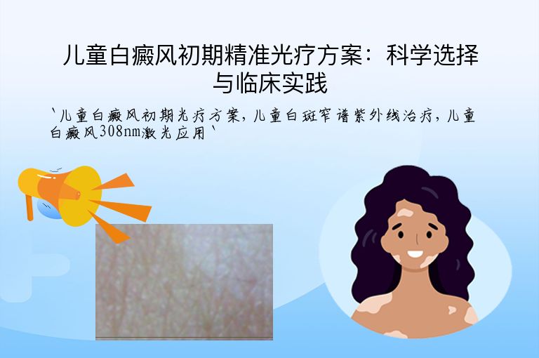 儿童白癜风初期精准光疗方案：科学选择与临床实践