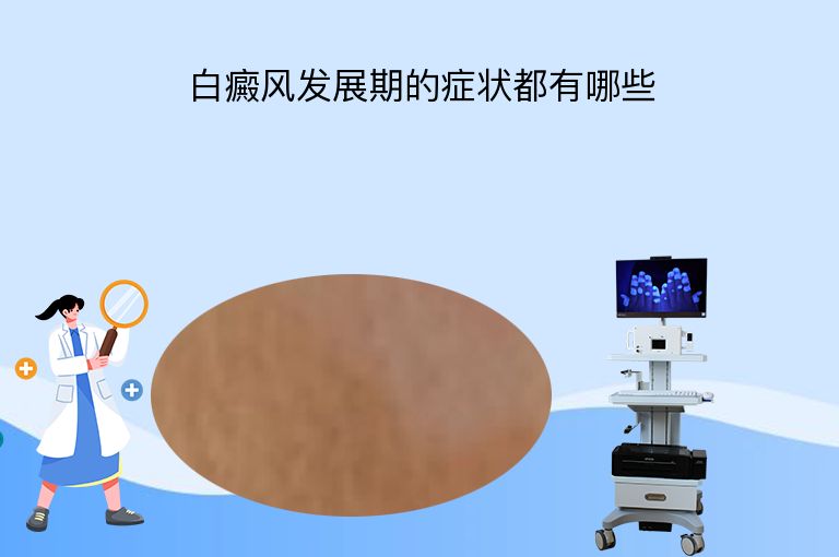 白癜风发展期的症状都有哪些