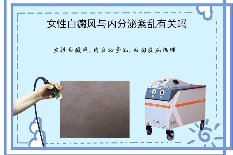 女性白癜风与内分泌紊乱有关吗”
