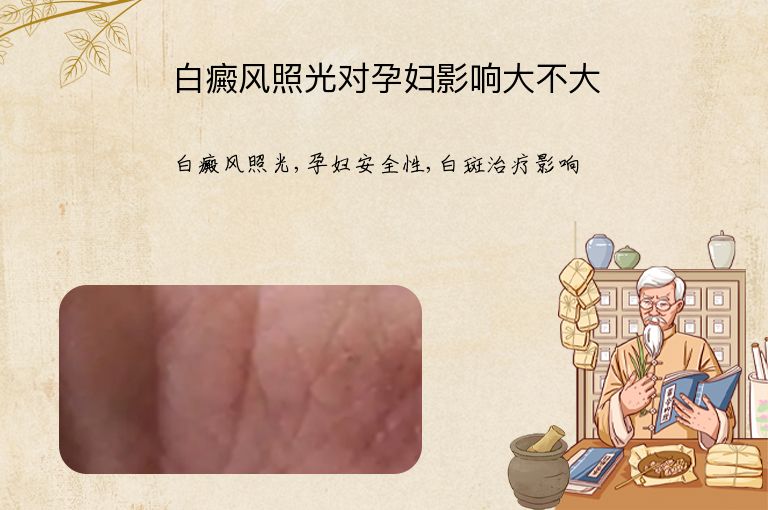 白癜风照光对孕妇影响大不大”
