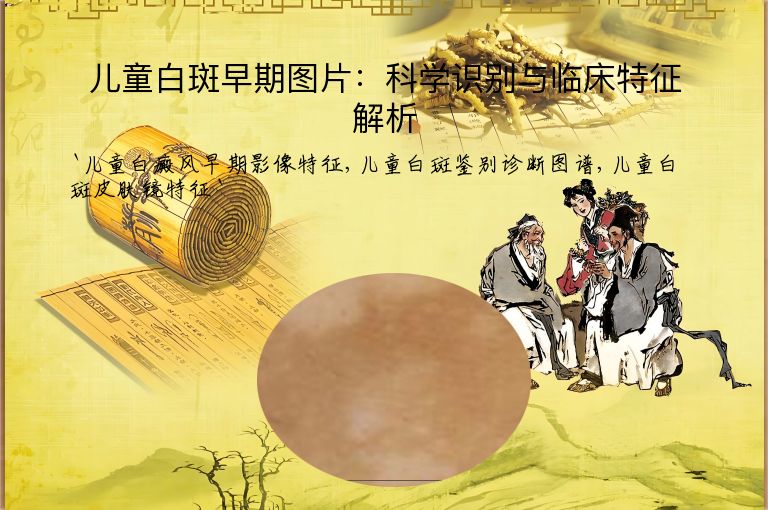 儿童白斑早期图片：科学识别与临床特征解析