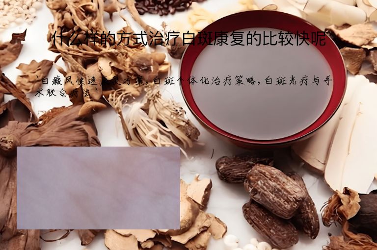 什么样的方式治疗白斑康复的比较快呢