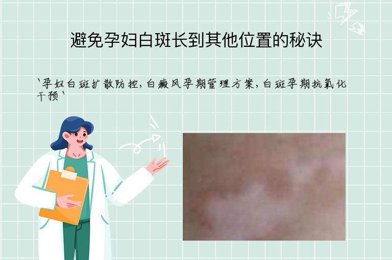避免孕妇白斑长到其他位置的秘诀