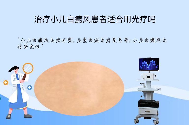 治疗小儿白癜风患者适合用光疗吗