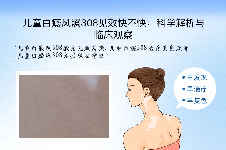 儿童白癜风照308见效快不快：科学解析与临床观察