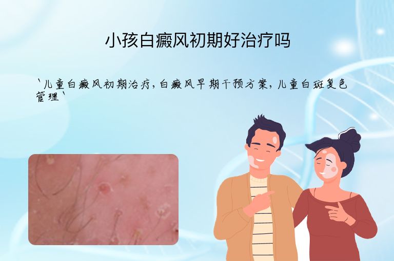 小孩白癜风初期好治疗吗