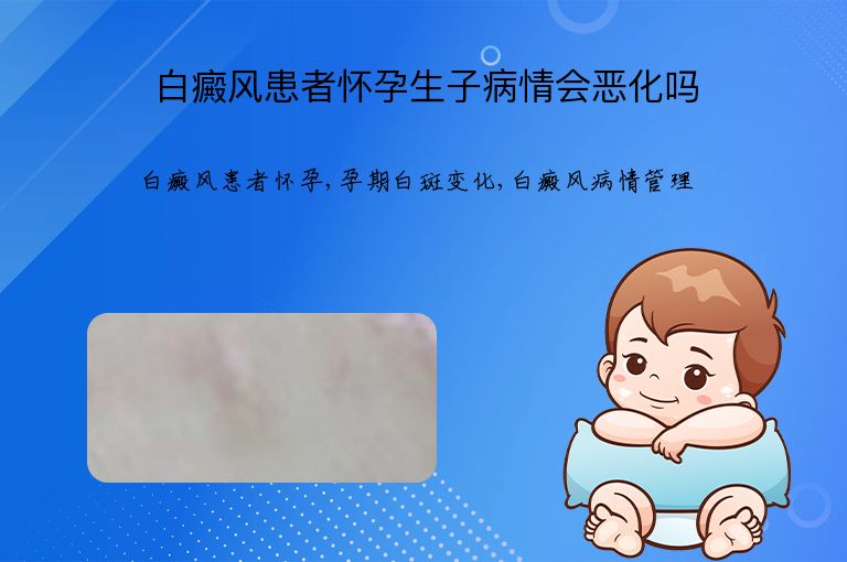 白癜风患者怀孕生子病情会恶化吗”