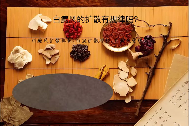 白癜风的扩散有规律吗？”