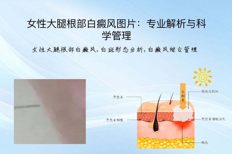 https://www.bdfsjzyy.com/d/file/p/bd90f118fd88a4d52ac2d5f8a8fc1459.jpeg